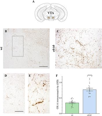 Orexin-A/Hypocretin-1 Controls the VTA-NAc Mesolimbic Pathway via Endocannabinoid-Mediated Disinhibition of Dopaminergic Neurons in Obese Mice